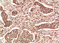 Anti-NME1 antibody (STJ197344) – Figure 1 of 1