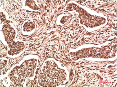 Anti-NME1 antibody (STJ197344) – Figure 1 of 1
