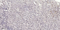 Anti-NBR1 antibody (STJ197345) – Figure 1 of 1