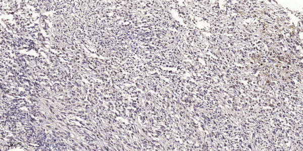 Anti-NBR1 antibody (STJ197345) – Figure 1 of 1