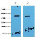 Anti-MECP2 antibody (313-363 aa) (STJ197348) – Figure 1 of 1