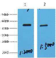 Anti-MECP2 antibody (313-363 aa) (STJ197348) – Figure 1 of 1