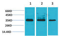 Anti-CACNG4 antibody (120-200 aa) (STJ197352) – Figure 1 of 1
