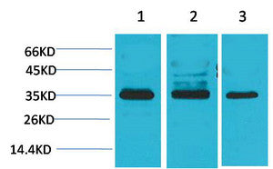 Anti-CACNG4 antibody (120-200 aa) (STJ197352) – Figure 1 of 1