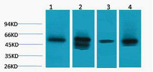 Anti-LDHD antibody (STJ197354) – Figure 1 of 1