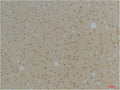 Anti-KCNAB1 antibody (66-116 aa) (STJ197356) – Figure 1 of 1