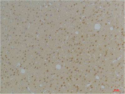 Anti-KCNAB1 antibody (66-116 aa) (STJ197356) – Figure 1 of 1