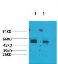 Anti-KCNV2 antibody (STJ197358) – Figure 1 of 1