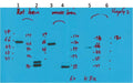 Anti-KCNH5 antibody (264-314 aa) (STJ197359) – Figure 1 of 1