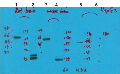 Anti-KCNH5 antibody (264-314 aa) (STJ197359) – Figure 1 of 1