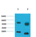 Anti-KCNA10 antibody (194-244 aa) (STJ197361) – Figure 1 of 1