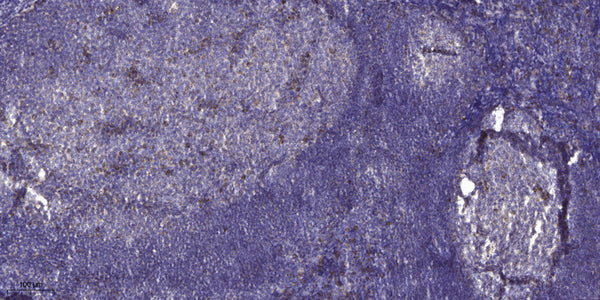 Anti-KNG1 antibody (STJ197362) – Figure 1 of 1