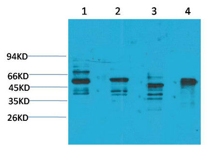 Anti-KCNN4 antibody (177-227 aa) (STJ197363) – Figure 1 of 1
