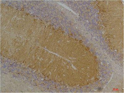 Anti-KCNN3 antibody (161-211 aa) (STJ197364) – Figure 1 of 1