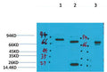 Anti-KCNN2 antibody (STJ197365) – Figure 1 of 1