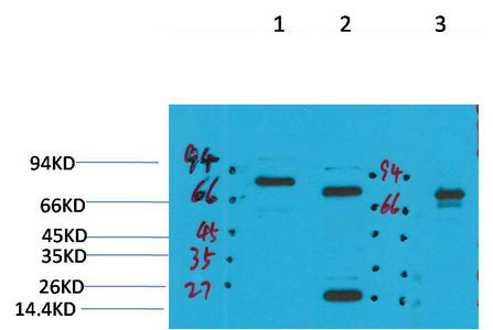 Anti-KCNN2 antibody (STJ197365) – Figure 1 of 1