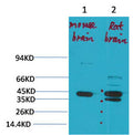 Anti-KCNK9 antibody (220-270 aa) (STJ197366) – Figure 1 of 1