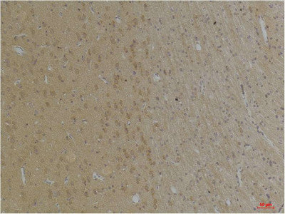 Anti-KCNK4 antibody (38-88 aa) (STJ197367) – Figure 1 of 1