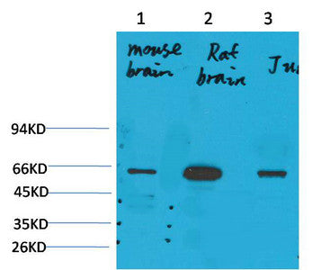 Anti-KCNK10 antibody (16-66 aa) (STJ197368) – Figure 1 of 1