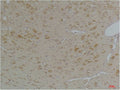 Anti-KCNIP3 antibody (169-219 aa) (STJ197369) – Figure 1 of 1