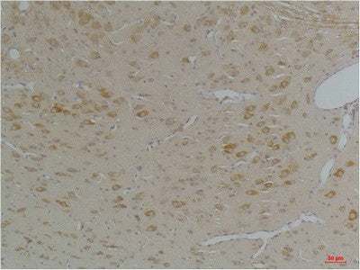 Anti-KCNIP3 antibody (169-219 aa) (STJ197369) – Figure 1 of 1