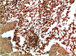 Anti-MAPK9 antibody (STJ197370) – Figure 1 of 1