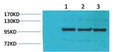 Anti-IGFN1 antibody (STJ197371) – Figure 1 of 1