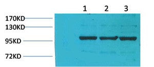 Anti-IGFN1 antibody (STJ197371) – Figure 1 of 1