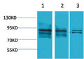 Anti-ARNT antibody (STJ197372) – Figure 1 of 1