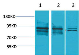 Anti-ARNT antibody (STJ197372) – Figure 1 of 1