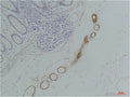 Anti-GRIK2 antibody (119-169 aa) (STJ197375) – Figure 1 of 1