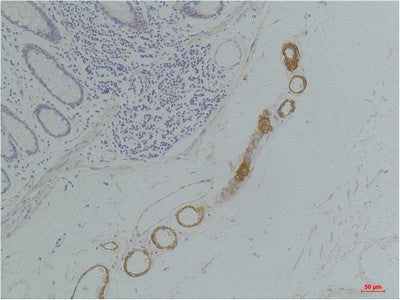 Anti-GRIK2 antibody (119-169 aa) (STJ197375) – Figure 1 of 1