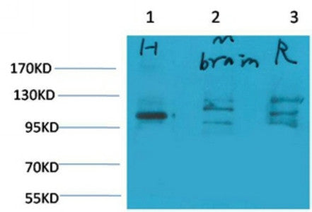 Anti-GRIA1 antibody (773-823 aa) (STJ197376) – Figure 1 of 1