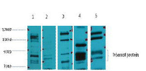 Anti-NR3C1 antibody (STJ197377) – Figure 1 of 1