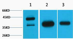Anti-GAP43 antibody (STJ197381) – Figure 1 of 1