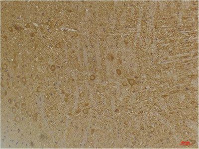 Anti-GABBR2 antibody (785-835 aa) (STJ197385) – Figure 1 of 1