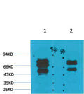 Anti-GABRG2 antibody (STJ197386) – Figure 1 of 1