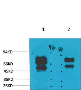 Anti-GABRG2 antibody (STJ197386) – Figure 1 of 1