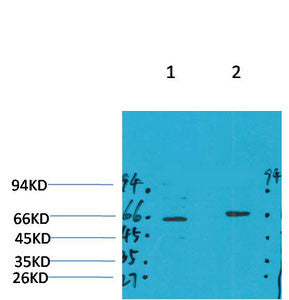 Anti-GABRA4 antibody (149-199 aa) (STJ197387) – Figure 1 of 1