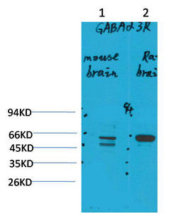 Anti-GABRA3 antibody (51-101 aa) (STJ197388) – Figure 1 of 1