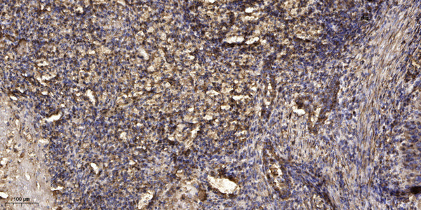 Anti-GAB1 antibody (STJ197390) – Figure 1 of 1