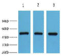 Anti-FH antibody (STJ197391) – Figure 1 of 1