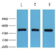 Anti-FH antibody (STJ197391) – Figure 1 of 1