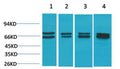 Anti-ESR1 antibody (STJ197393) – Figure 1 of 1