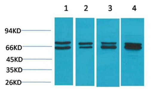 Anti-ESR1 antibody (STJ197393) – Figure 1 of 1