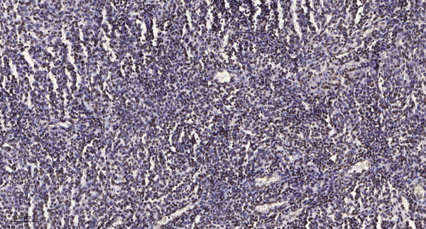 Anti-MAPK3 antibody (STJ197394) – Figure 1 of 1