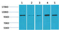 Anti-MAPK7 antibody (STJ197395) – Figure 1 of 1