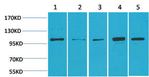 Anti-MAPK7 antibody (STJ197395) – Figure 1 of 1