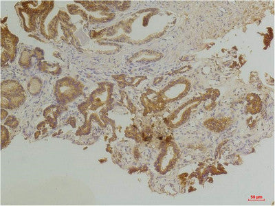 Anti-EDNRB antibody (270-350 aa) (STJ197396) – Figure 1 of 1