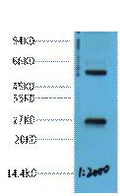Anti-EFHD1 antibody (STJ197397) – Figure 1 of 1
